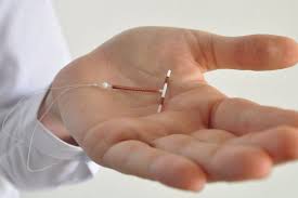 The copper iud is a device inserted into the uterus to prevent pregnancy. Paragard Lawsuit Claims Copper Iud Broke In Uterus Medtruth Prescription Drug Medical Device Safety Informed Advocacy