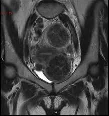 On mdsave, the cost of a ct scan without contrast ranges from $158 to $1,267. Ct Scan Of The Pelvis Hip Bones Cedars Sinai
