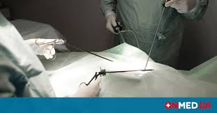 Ιωαννησ βακαλοπουλοσ χειρουργός ουρολόγος ανδρολόγος. Apofra3h Leptoy Enteroy Giati H Laparoskopikh Xeiroyrgikh Yperterei Onmed Gr