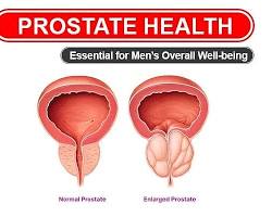 Image of healthy prostate