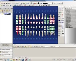 Dentrix Patient Chart Toolbar Missing New Pt In Dentrix