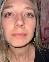 title Great lips don't happen by chance, they happen by appointment 😉  Swipe to see the before ← 📲832.558.1785 #deannapoutmedspa #deannaashley  #fillers #lips #houstonmedspa #houstonbeauty #houstoninjector #beauty  #fillers #wellness #medspalife ...