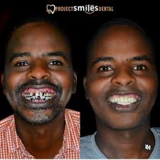 Dr. Nadeem Qadri (Adam Poly Clinic & Dental Care) in Toli Chowki,Hyderabad 