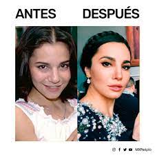 Got anymore yoseline hoffman feet pictures? Periplo Galeria Cirugia De Nariz Labios Cachetitos Facebook