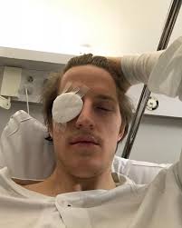 Granlostjärnan tvingades till akut ögonoperation: "Har knappt kunnat stå  upp"