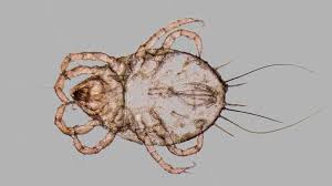 Image result for Dust mite