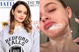 Joey King Suffered Burns to Her Face While Cooking