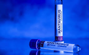 OMS eleva a 11 los casos positivos por hantavirus; 