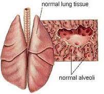To diagnose the condition, monitor your cat. Lungs All Feline Hospital Located 2300 S 48th St Suite 3 Lincoln Ne 68506