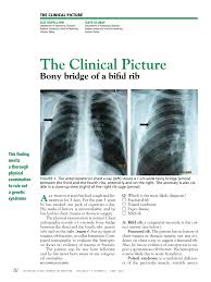 The heart heart is a very important organ which acts as a muscular pump. Pdf Bony Bridge Of A Bifid Rib