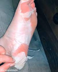 Nifty Foot Peel Facebook