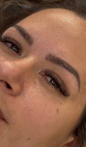 Hey all, My friend is looking for someone who is needing models for lip  injections. Western suburbs! Thank you 🙂