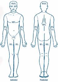 Assessing Burns And Planning Resuscitation The Rule Of Nines Level One Newsletter Emergency Medicine Uw Health Madison Wi