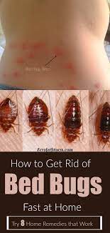 How To Get Rid Of Bed Bugs Fast 8 Home Remedies That Work Rid Of Bed Bugs Bed Bugs Home Remedies