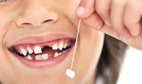 Rever De Perdre Ses Dents Signification Dent Tafsir Azhar