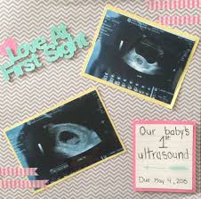 Ultrasound Scrapbook Page Baby Girl Scrapbook Baby Scrapbook Pages Baby Scrapbook