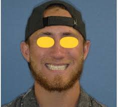 Table Rock Oral Surgery (@tablerockoralsurgery) · Instagram 照片和视频