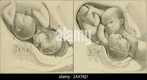 Image result for Compound Presentation