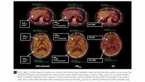 Toner manufacturer jadi imaging holdings bhd has been under the radar of investors for years. Characterization Of Malignant Lung Lesions By Whole Body Parametric Pet Imaging