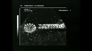 Image result for Aquamarine Blue 1990 Daewoo