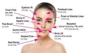 How botox injections treat tmj and bruxism. How Much Botox Do I Need Botox Injection Sites Botox Injection Botox