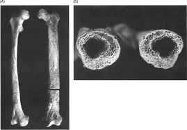 Image result for periostitis