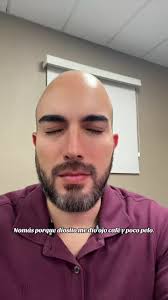 Mis ojos básicos y su impacto personal