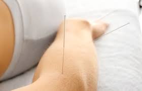 Pin On Medical Interests