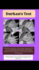 Image result for Carpal Compression Test
