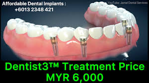 Cabut gigi geraham diperlukan jika kondisi gigi sudah rusak parah. Dental Articles Archives Dentist Malaysia