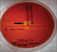 Image result for Rhodococcus equi
