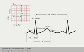 my top 10 tips for ecg interpretation the british journal