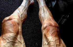 Les enquêteurs ont effectué plusieurs dizaines d'auditions depuis les coureurs du tour de france ont manifesté mardi leur mécontentement face à la multiplication des chutes, en mettant pied à terre pendant une minute. Les Ravages Du Tour De France Sur Les Jambes Des Coureurs Photos