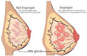 How long a period lasts varies from person to person. Mastitis Breast Infection Symptoms Homeopathic Treatment