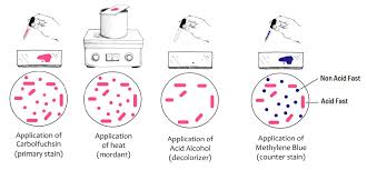 Acid-Fast Stain