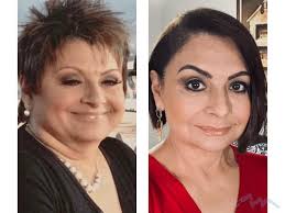 Dr. Wolf's Facelift Patients