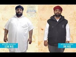 Pin On Bariatric Surgery India Punjab