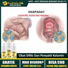 Sipilis juga dikenal sebagai sifilis atau raja singa. Obat Tetes Raja Singa Pria Dan Wanita Bisa Cod Asli Original Obat Sipilis Sivilis Sifilis Raja Singa Gonohrea Gonorhea Gonore Infeksi Kelamin Nyeri Sakit Kencing Propolis Sm Murah Lazada Indonesia