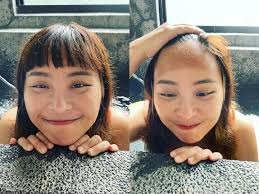 開水小姐- 瀏海與曬傷。🦭