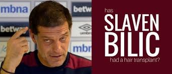 Slaven bilić (pronounced slǎʋen bǐːlitɕ; Sports Stars Top Hair Loss Treatments