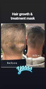 2 oz. Hair Growth & Treatment Mask ♥️ | Bespoke Apothecary = Custom Made,  Herbal Medicine