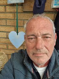 Blepharoplasty Support Group