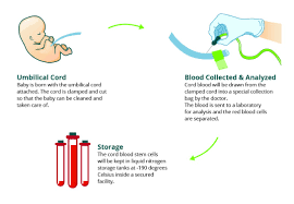 It contains special cells called hematopoietic stem cells that can be used to placenta: Umbilical Cord Blood Banking A Need For Healthy Society By Babycell Medium