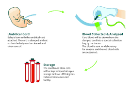 For more information about the nhs cord blood bank, Umbilical Cord Blood Banking A Need For Healthy Society By Babycell Medium