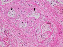 Its county seat and most populous municipality is the city of rutland. Preeclampsia Circulation Research