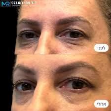 ד"ר מתי רוזנבלט,...