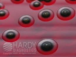 Agar (bgs) and brilliant green agar (bg) were found to be superior. Xld Agar Alchetron The Free Social Encyclopedia