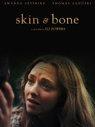 Prime Video: Skin and Bone