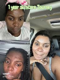 20 top Toko Skincare Love Me Yng Ad Di Kota Ambon ideas in 2024