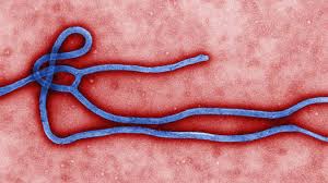 In its early stages, however, symptoms of ebola are often. Ebola Virus And Disease